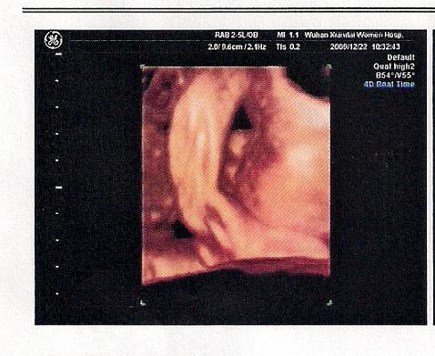 �ȱȲ���̥��